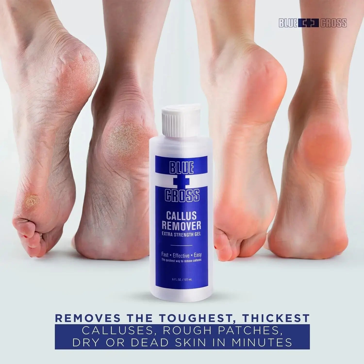 Blue Cross Callus Remover Callous 6 oz - Premier Nail Supply