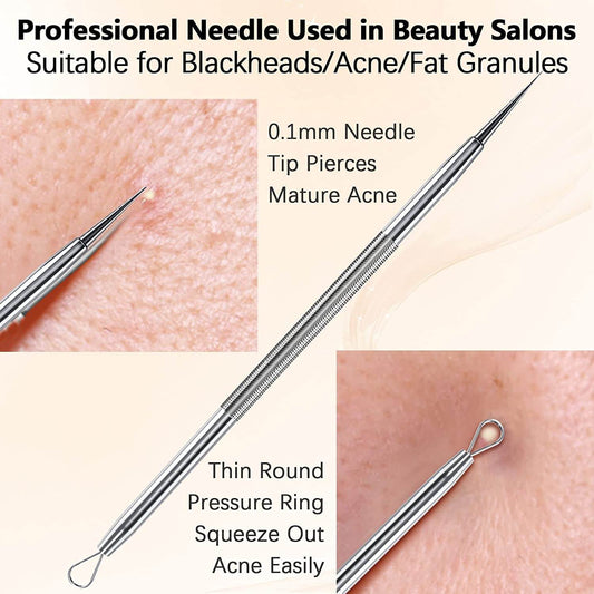 Blackhead remover Gold tool #6186-3